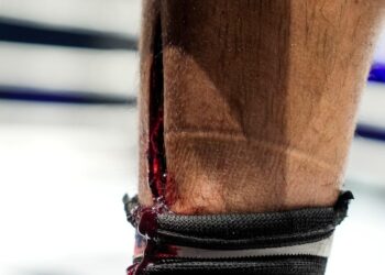 Pic! This Cut To The Shin Is Something Else