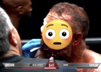 Video: Brutal bare-knuckle war leaves boxer’s face unrecognizable (NSFW)