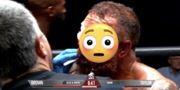 Video: Brutal bare-knuckle war leaves boxer’s face unrecognizable (NSFW)